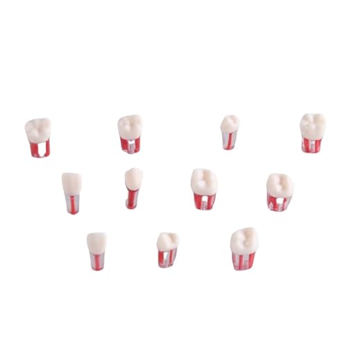 FHUILIJH 11 Stück Zahnärztliche endodontische Wurzelkanalpraxis Endozähne Zahnmodell Zahnlehre Prüfung Offene Pulpa Pellet Übungsmodell,Flesh,5cm FHUILIJH 11 Stück Zahnärztliche endodontische Wurzelkanalpraxis Endozähne Zahnmodell Zahnlehre Prüfung Offene Pulpa Pellet Übungsmodell,Flesh,5cm von FHUILIJH