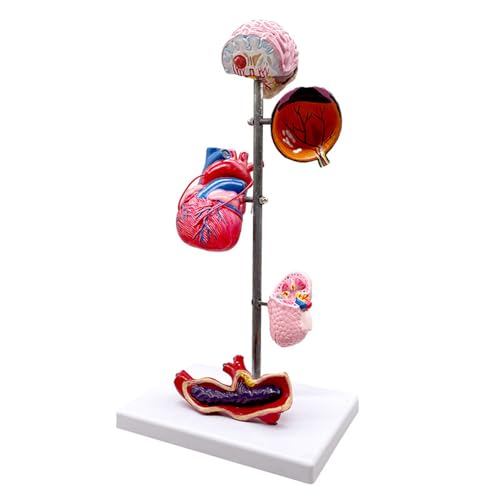 FHUILIJH Medizinisches anatomisches Hypertonie-Organ-Modell-Set Menschliches Hypertonie-Organ Anatomisches Modell Bildungsgehirn Auge Herz Niere Blutgefäße Modell,Flesh,45cm von FHUILIJH