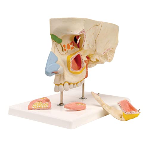 UIGJIOG Anatomisch vergrößertes Modell der Nase und Nasennebenhöhlen, Nasen -menschliches Anatomie -Modell mit paranalen Hohlräumen, unterteilt in 5 Teile 1,5 -fache Vergrößerung von UIGJIOG