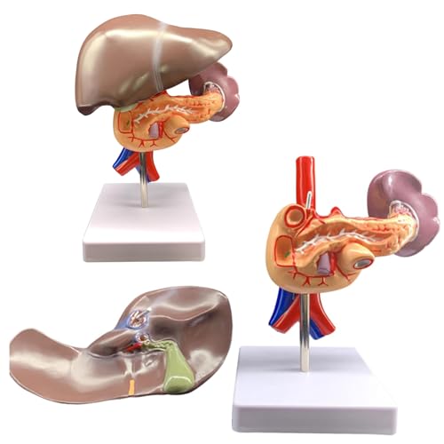 UIGJIOG Modell Erkrankten Menschlichen Bauchspeicheldrüse,Modell Menschlichen Zwölffingerdarms Bauchspeicheldrüse Milz Organanatomie Modell Bauchspeicheldrüse Milz Leber Gallenblase Zwölffingerdarm von UIGJIOG